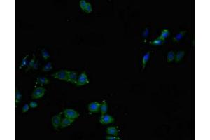 Immunofluorescent analysis of HepG2 cells using ABIN7147018 at dilution of 1:100 and Alexa Fluor 488-congugated AffiniPure Goat Anti-Rabbit IgG(H+L) (Cathepsin L 抗体  (AA 114-288))