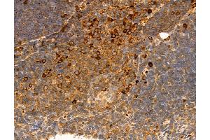 ABIN6264374 and ABIN6272975 at 1/100 staining Mouse thymus tissue by IHC-P. (PPAT 抗体  (N-Term))