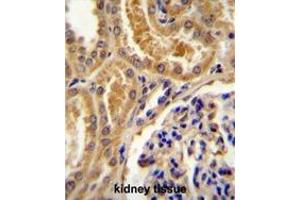 TLL2 Antibody (Center) immunohistochemistry analysis in formalin fixed and paraffin embedded human kidney tissue followed by peroxidase conjugation of the secondary antibody and DAB staining. (Tolloid-Like 2 抗体  (Middle Region))