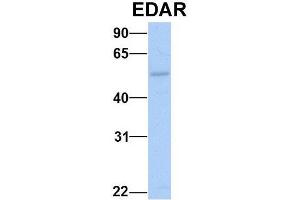 Host:  Rabbit  Target Name:  NOP56  Sample Type:  Human Fetal Muscle  Antibody Dilution:  1. (EDAR 抗体  (Middle Region))