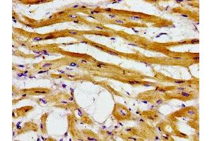 Immunohistochemistry of paraffin-embedded human heart tissue using ABIN7143334 at dilution of 1:100 (ADCY6 抗体  (AA 9-118))