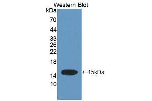 Western blot analysis of the recombinant protein. (Trichohyalin 抗体  (AA 1851-1943))