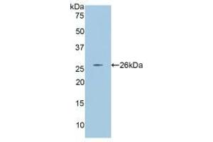 Western blot analysis of recombinant Rat ANGPT2. (Angiopoietin 2 抗体  (AA 33-243))