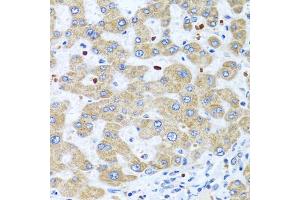 Immunohistochemistry of paraffin-embedded human liver using NMU antibody (ABIN5975084) at dilution of 1/100 (40x lens). (Neuromedin U 抗体)