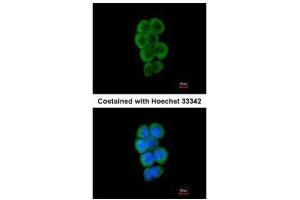 ICC/IF Image Immunofluorescence analysis of methanol-fixed A431, using CBL, antibody at 1:50 dilution. (CBL 抗体  (C-Term))