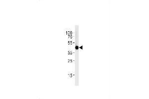 Western Blotting (WB) image for anti-Interferon Regulatory Factor 2 Binding Protein 2 (IRF2BP2) (AA 238-260) antibody (ABIN1881464)