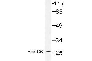 Image no. 1 for anti-Homeobox C6 (HOXC6) antibody (ABIN272159) (Homeobox C6 抗体)