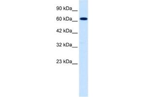 Western Blotting (WB) image for anti-Sodium Channel, Nonvoltage-Gated 1, beta (SCNN1B) antibody (ABIN2461078) (SCNN1B 抗体)