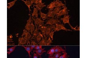 Immunofluorescence analysis of C6 cells using ADAM12 Polyclonal Antibody at dilution of 1:100. (ADAM12 抗体)