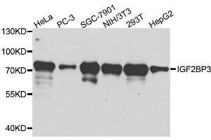 Western Blotting (WB) image for anti-Insulin-Like Growth Factor 2 mRNA Binding Protein 3 (IGF2BP3) (AA 1-200) antibody (ABIN3016599)