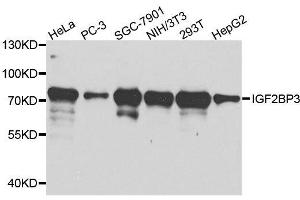 Western blot analysis of extracts of various cell lines, using IGF2BP3 antibody. (IGF2BP3 抗体  (AA 1-200))
