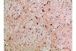 Immunohistochemistry (IHC) image for anti-NLR Family Member X1 (NLRX1) (AA 581-630) antibody (ABIN7184523)