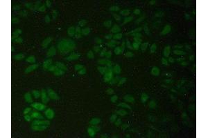 Detection of PFKP in Human Hela Cells using Polyclonal Antibody to Phosphofructokinase, Platelet (PFKP) (PFKP 抗体  (AA 354-570))