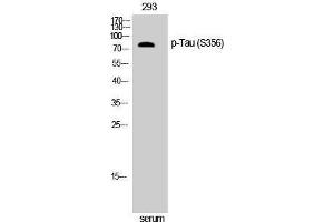 Western Blotting (WB) image for anti-tau Protein (pSer356) antibody (ABIN3182161) (tau 抗体  (pSer356))
