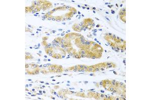 Immunohistochemistry of paraffin-embedded human stomach using ApoE antibody (ABIN5975768) at dilution of 1/100 (40x lens). (APOE 抗体)