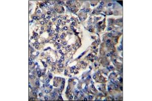 Immunohistochemistry analysis in Formalin Fixed, Paraffin Embedded Human pancreas tissue using RPL35 Antibody (C-term) followed by peroxidase conjugation of the secondary antibody and DAB staining. (RPL35 抗体  (C-Term))