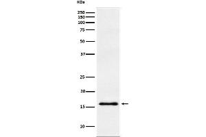 Western blot analysis of gamma Synuclein expression in human fetal brain lysate.