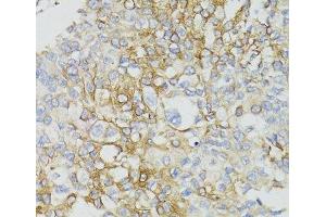 Immunohistochemistry (Paraffin-embedded Sections) (IHC (p)) image for anti-Mitochondrially Encoded NADH Dehydrogenase 5 (MT-ND5) antibody (ABIN7264181)