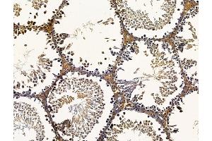 ABIN7096241 and ABIN7100303 at 1/100 staining rat testis tissue by IHC-P. (SAMD3 抗体)