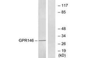 Western blot analysis of extracts from LOVO cells, using GPR146 Antibody. (GPR146 抗体  (AA 191-240))