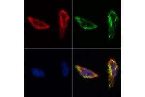ABIN6261894 and ABIN6268716 staining Hela by IF/ICC. (GATA5 抗体  (Internal Region))