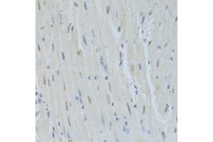 Immunohistochemistry of paraffin-embedded mouse heart using HNRNPK Antibody.