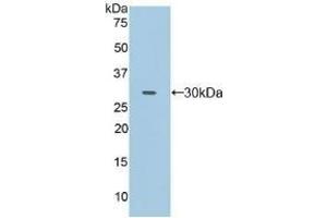 Detection of Recombinant FcgRII, Human using Polyclonal Antibody to Cluster Of Differentiation 32 (CD32) (Fc gamma RII (CD32) (AA 69-309) 抗体)