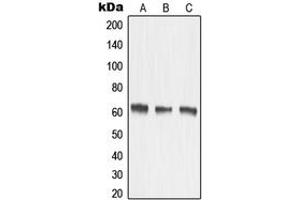 Western blot analysis of MMP15 expression in HeLa (A), mouse kidney (B), rat kidney (C) whole cell lysates. (MMP15 抗体  (Center))