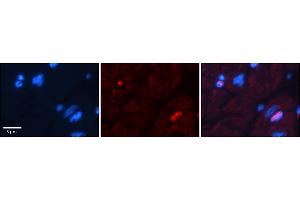 Immunohistochemistry (IHC) image for anti-D4, Zinc and Double PHD Fingers, Family 3 (DPF3) (N-Term) antibody (ABIN2780850)