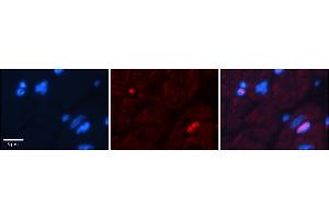 Rabbit Anti-Dpf3 Antibody  Catalog Number: ARP38943_P050 Formalin Fixed Paraffin Embedded Tissue: Human Adult heart  Observed Staining: Nuclear (not in cardiomyocytes but in fibrocytes in endomysium Primary Antibody Concentration: 1:600 Secondary Antibody: Donkey anti-Rabbit-Cy2/3 Secondary Antibody Concentration: 1:200 Magnification: 20X Exposure Time: 0. (DPF3 抗体  (N-Term))