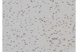 ABIN6266296 and ABIN6277446 at 1/100 staining Rat heart tissue by IHC-P. (INA 抗体  (Internal Region))