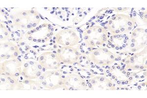 Detection of APOB100 in Bovine Kidney Tissue using Polyclonal Antibody to Apolipoprotein B100 (APOB100) (Apo-B100 抗体  (AA 4331-4567))