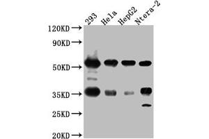Western Blot Positive WB detected in: 293 whole cell lysate, Hela whole cell lysate, HepG2 whole cell lysate, Ntera-2 whole cell lysate All lanes: NONO Antibody at 1:1000 Secondary Goat polyclonal to rabbit IgG at 1/50000 dilution Predicted band size: 55, 44 kDa Observed band size: 55 kDa (Recombinant NONO 抗体)