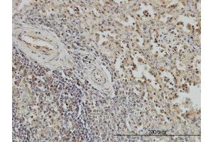 Immunostaining (ISt) image for anti-Budding Uninhibited By Benzimidazoles 1 Homolog beta (Yeast) (BUB1B) (AA 1-130) antibody (ABIN560109)