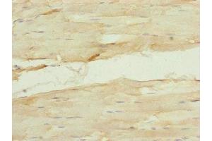 Immunohistochemistry of paraffin-embedded human skeletal muscle tissue using ABIN7157665 at dilution of 1:100 (NUF2 抗体  (AA 165-464))