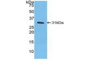 Detection of Recombinant CA3, Human using Polyclonal Antibody to Carbonic Anhydrase III, Muscle Specific (CA3) (CA3 抗体  (AA 2-260))