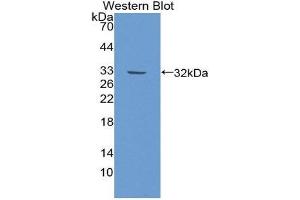 Western Blotting (WB) image for anti-Inter-alpha Globulin Inhibitor H2 Polypeptide (ITIH2) (AA 452-702) antibody (ABIN1868779) (ITIH2 抗体  (AA 452-702))