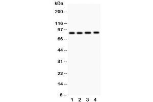 Western blot testing of NOX5 antibody and  Lane 1: 22RV1 (NOX5 抗体  (C-Term))