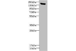 Western blot All lanes: CNTNAP1antibody IgG at 1. (CNTNAP1 抗体  (AA 20-300))