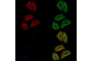 ABIN7094074 and ABIN7098118 staining Hela cells by IF/ICC.