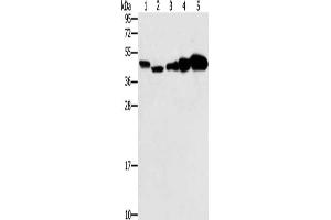 Gel: 10 % SDS-PAGE, Lysate: 40 μg, Lane 1-5: Hela cells, Raji cells, Jurkat cells, A549 cells, NIH/3T3 cells, Primary antibody: ABIN7130674(PPAT Antibody) at dilution 1/250, Secondary antibody: Goat anti rabbit IgG at 1/8000 dilution, Exposure time: 20 seconds (PPAT 抗体)