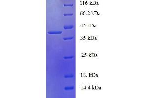 SDS-PAGE (SDS) image for phosphohistidine Phosphatase 1 (PHPT1) (AA 1-125), (full length) protein (GST tag) (ABIN5710093)
