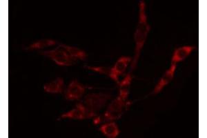 ABIN6272381 staining LOVO by IF/ICC. (PAK7 抗体  (C-Term))