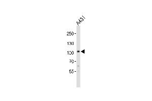 Western blot analysis of lysate from A431 cell line, using COL6A1 Antibody at 1:1000. (COL6A1 抗体  (C-Term))