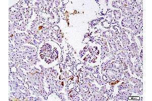 Formalin-fixed and paraffin embedded rat nephroblastoma labeled with Anti SET Polyclonal Antibody, Unconjugated (ABIN760166) at 1:200 followed by conjugation to the secondary antibody and DAB staining (SET/TAF-I 抗体)