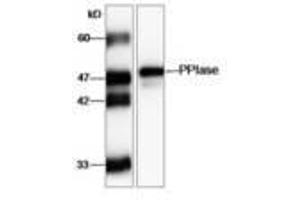 Image no. 1 for anti-FK506 Binding Protein 11, 19 KDa (FKBP11) (AA 28-201) antibody (ABIN791454) (FKBP11 抗体  (AA 28-201))