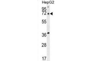 Western Blotting (WB) image for anti-Acyl-CoA Thioesterase 11 (ACOT11) antibody (ABIN2995532) (ACOT11 抗体)