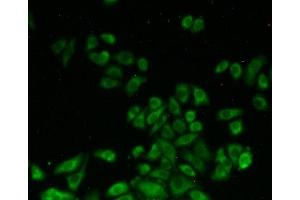 Detection of SHMT2 in Hela cells using Polyclonal Antibody to Serine Hydroxymethyltransferase 2, Mitochondrial (SHMT2) (SHMT2 抗体  (AA 30-504))