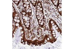 Immunohistochemical staining of human colon with JSRP1 polyclonal antibody  shows strong cytoplasmic and nuclear positivity in glandular cells. (JSRP1 抗体)