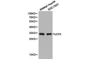 Western Blotting (WB) image for anti-Uncoupling Protein 3 (Mitochondrial, Proton Carrier) (UCP3) antibody (ABIN1875270) (UCP3 抗体)
